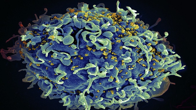 HIV (yellow) infecting a human immune cell (blue)